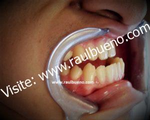 INICIO DE TRATAMIENTO