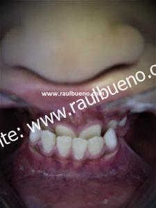 INICIO DE TRATAMIENTO