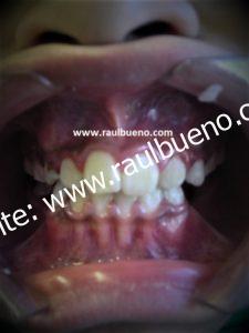 DESPUÉS DEL TRATAMIENTO