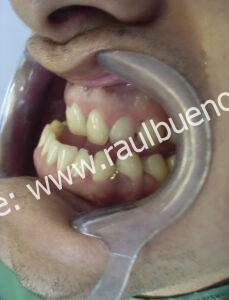 INICIO DE TRATAMIENTO