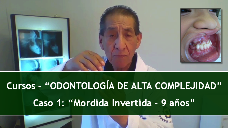 Lee más sobre el artículo CASO 1