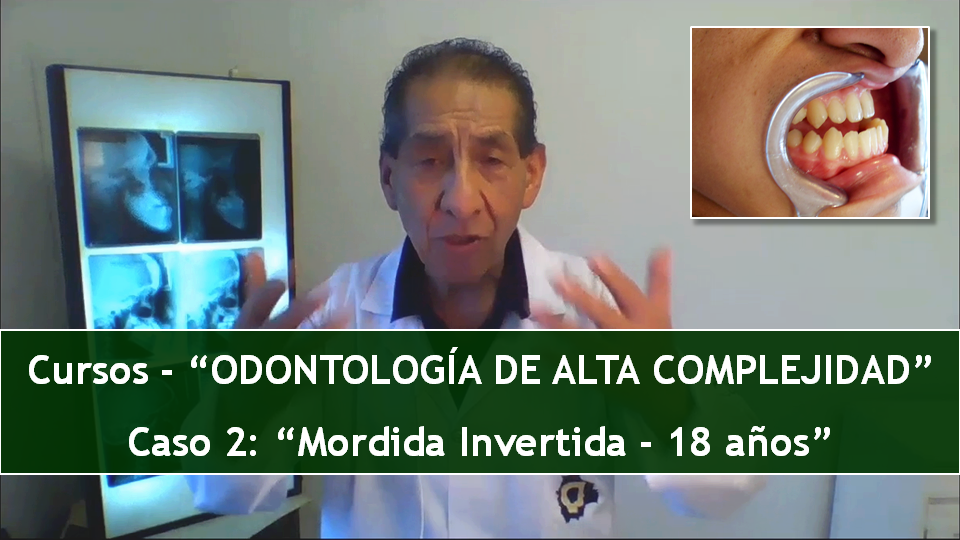 Lee más sobre el artículo CASO 2